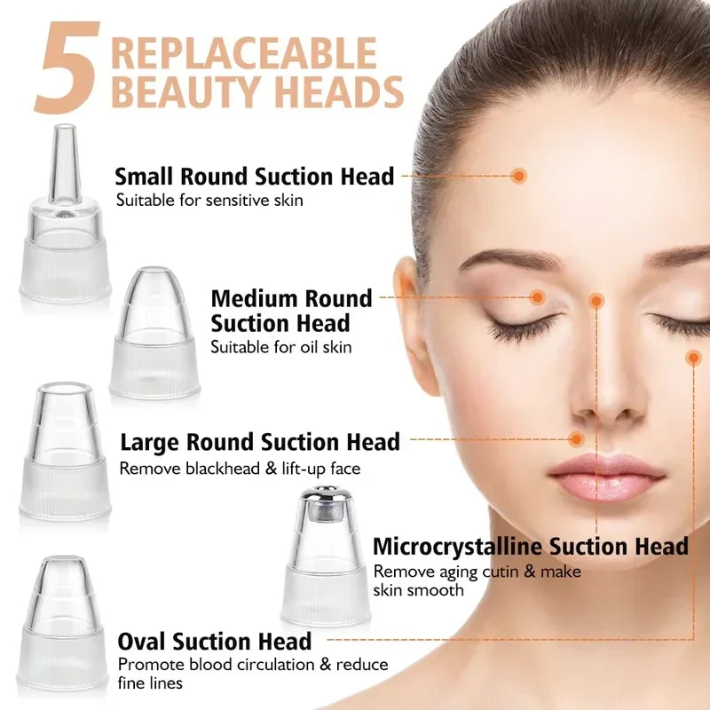 Removedor de Cravos a Vácuo, Limpador Facial de Poros, Dispositivo Elétrico para Remoção de Acne e Espinhas